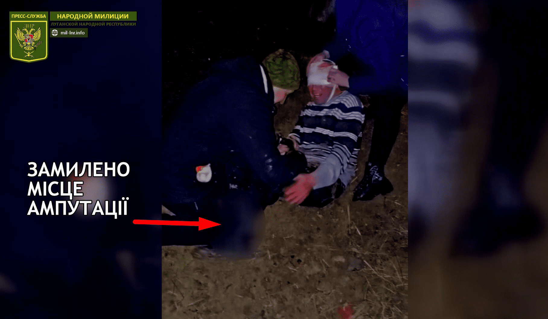 Кадр з відео з фейковим пораненим від "ЛНР"